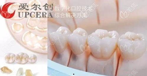 国产牙冠如何辨真伪视频  第3张
